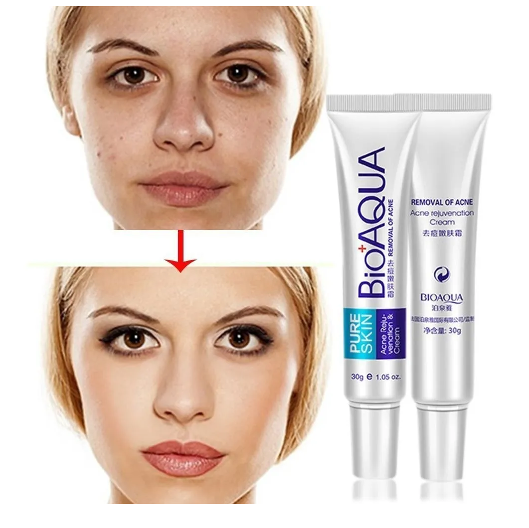 Bioaqua Crema Removedora De Acne